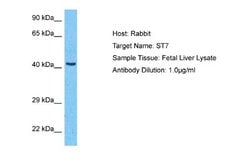 Suppression of Tumorigenicity 7 Antibody, Novus Biologicals 100 &mu;L;